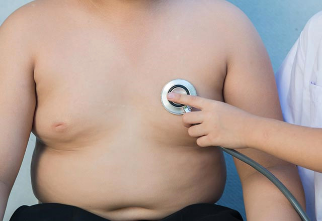 Obezite Tedavisi Nasıl Yapılır?