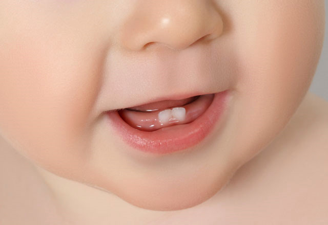 Bebeklerde Diş Çıkarma Süreci Nasıl Olur?